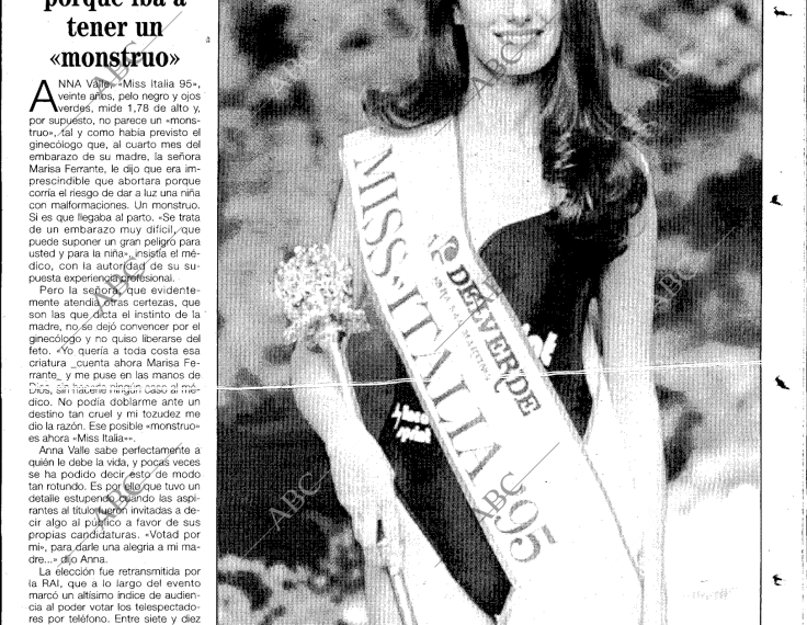 MISS ITALIA ANNA VALLE: A SU MADRE LE RECOMENDARON ABORTAR PORQUE IBA A TENER UN MONSTRUO